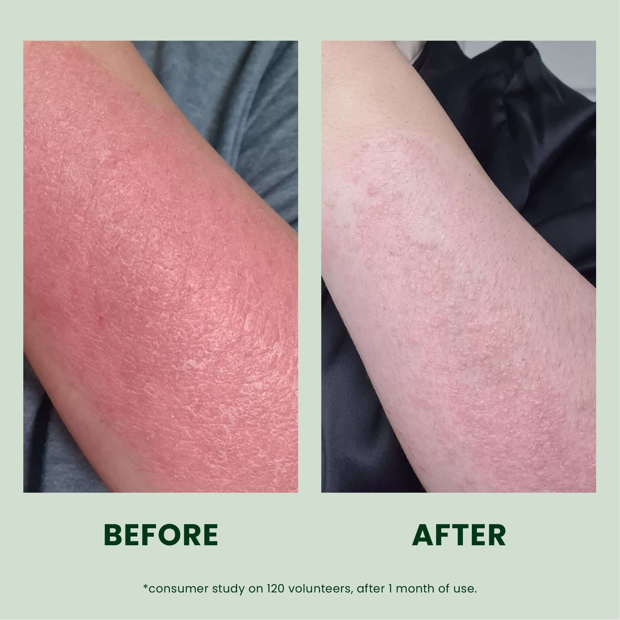 CBD Body Lotion 50ml Soothes Irritated Dry Sensitive Skin Antioxidant Skin Support